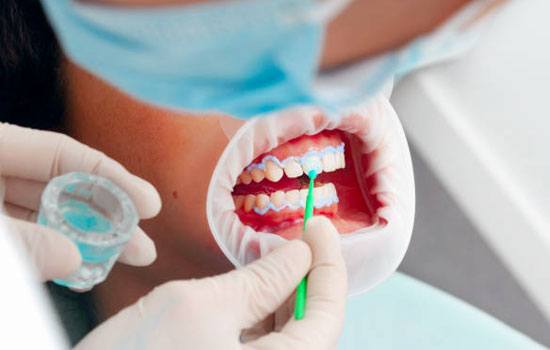 Cosmetic Dentistry treatment in Ghaziabad
